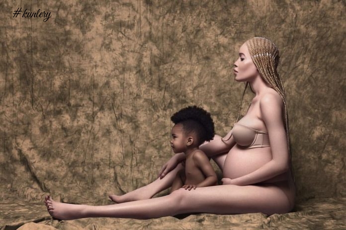 Albino Beauty Diandra Forest Gives Us Extremely Amazing Pregnant Mother & Child Images