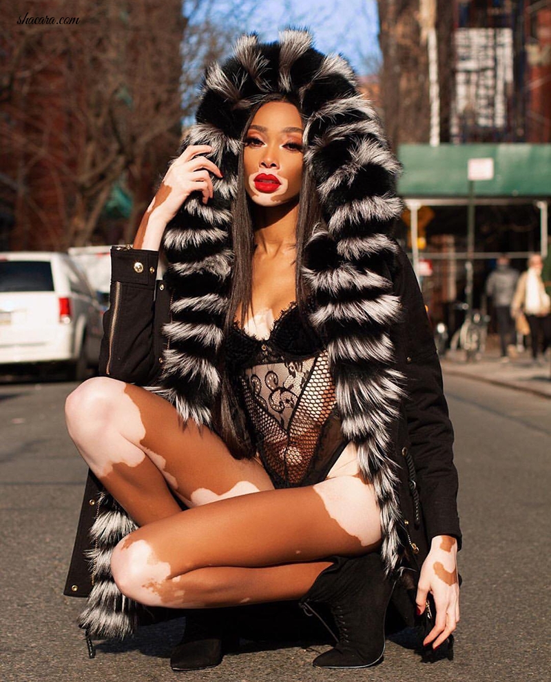 Vitiligo Model Winnie Breaks The Net Already In 2019 With This Fur Coat NYC Shoot
