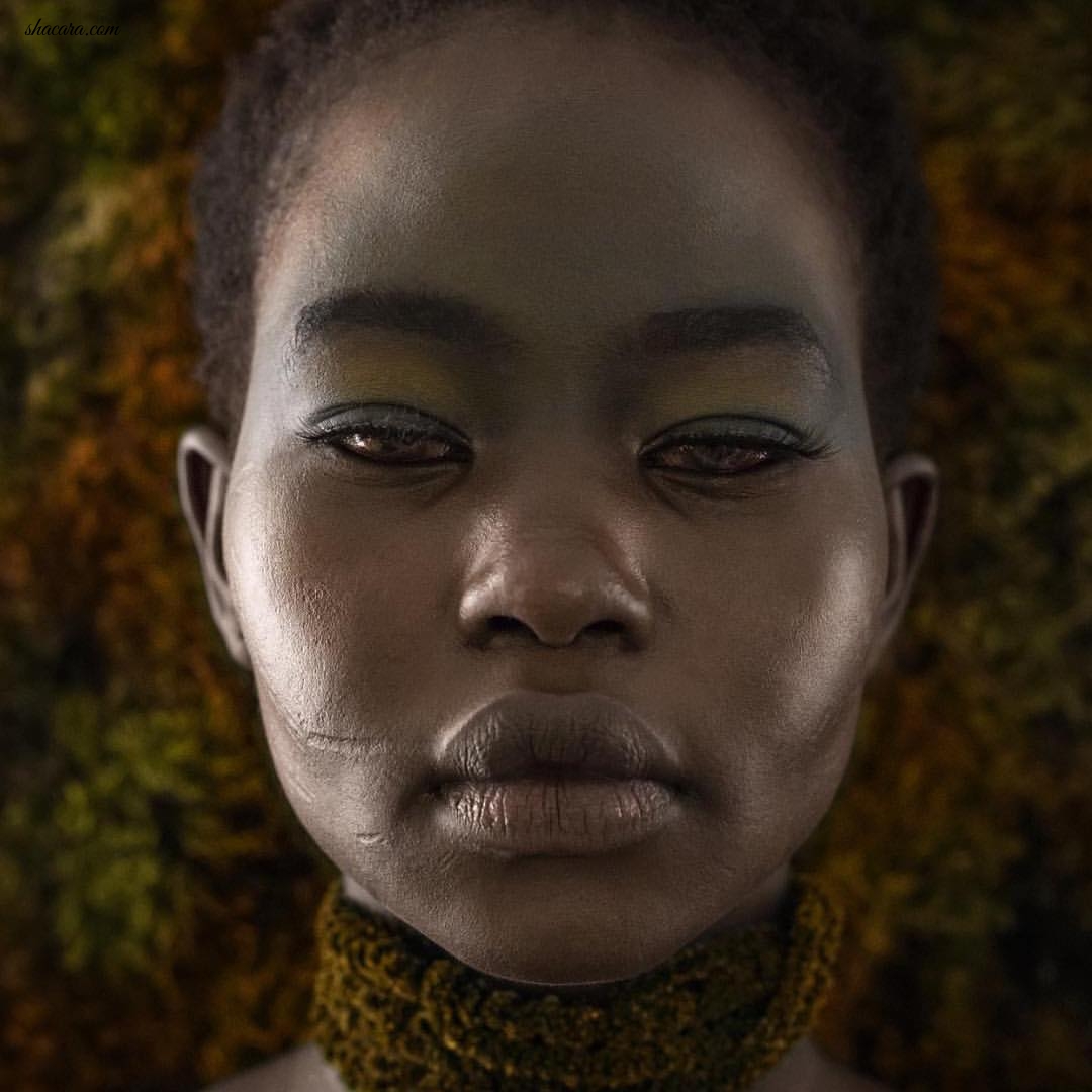 #MODELCRUSH: Meet The Eye Colour Changing Model Who’s Face Is Heavily Scared From Climbing Trees & Chasing Chickens & Still Successful