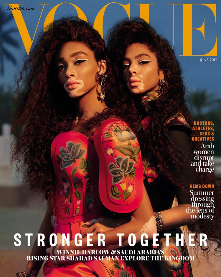 Vitiligo Can’t Stop Their Dreams! Models Winnie Harlow & Sahad Salman’s Inspiring Story in Vogue Arabia