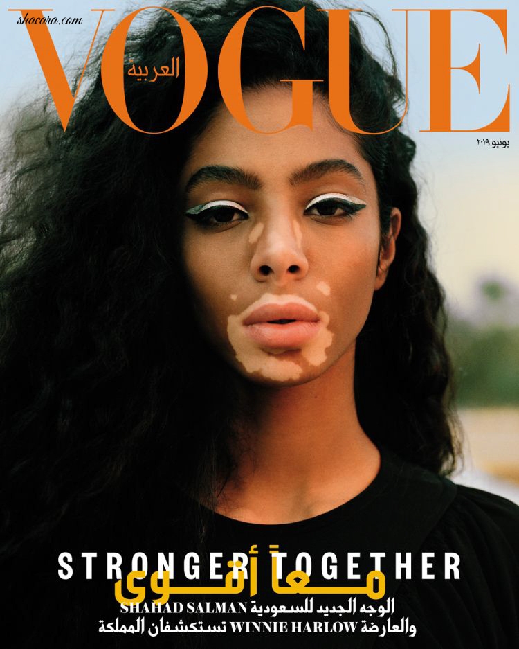 Vitiligo Can’t Stop Their Dreams! Models Winnie Harlow & Sahad Salman’s Inspiring Story in Vogue Arabia